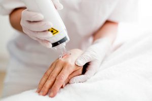 How to Prepare for Your First Laser Hair Removal Session