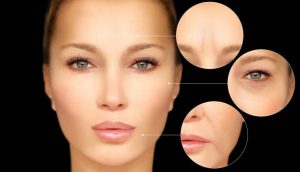 Top 5 Benefits of Choosing Dysport for Your Wrinkle Treatment